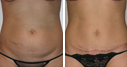 Before & After Photos